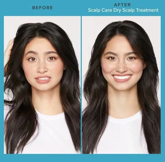 Living Proof Scalp Care Dry Scalp Treatment 100ml - Afbeelding 3