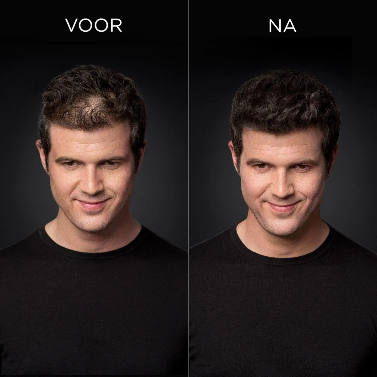 Toppik Colored Thickener Black 144gr - Afbeelding 2